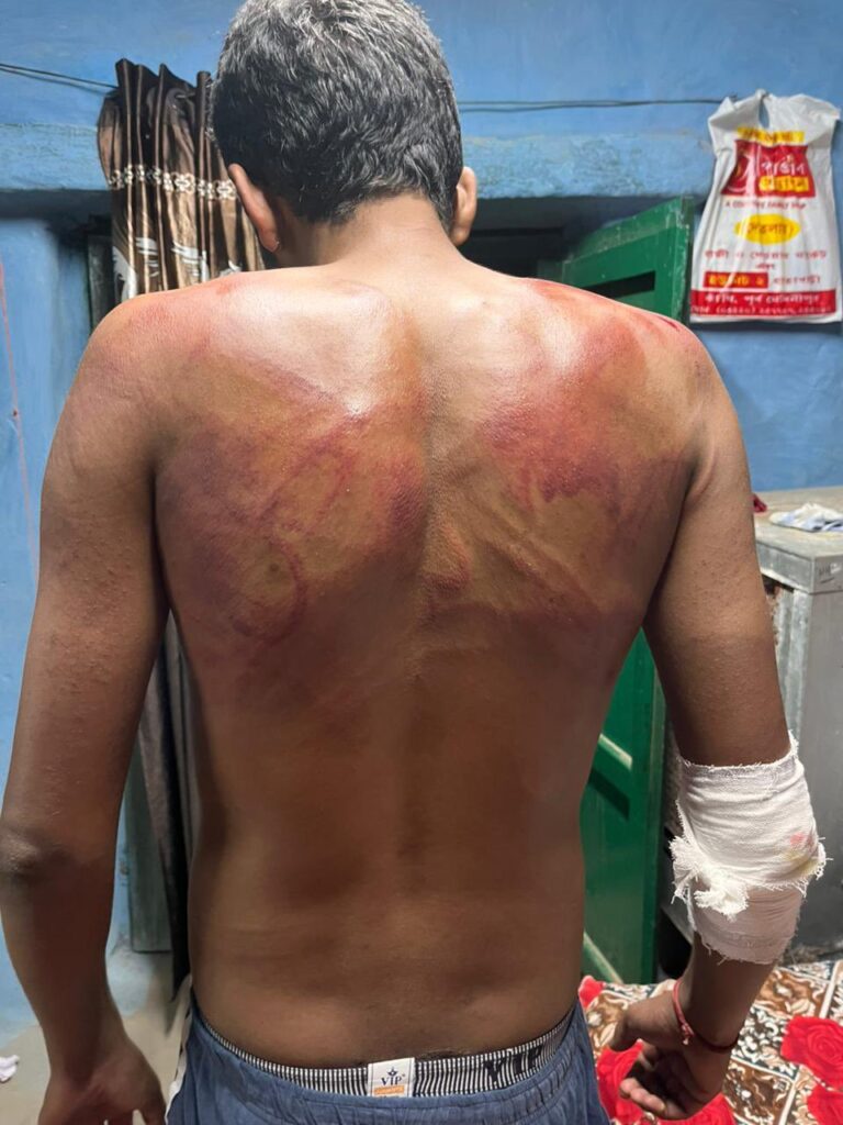 वीडियो देखिए,गृहमंत्री जी थोड़ा प्रदेश की कानून व्यवस्था पर भी ध्यान दे दीजिए छत्तीसगढ़ कानून व्यवस्था का हाल देखिए,बदमाशों के हौसले कितने बुलंद हैं,सवाल क्या यही है सुशासन कि सरकार,